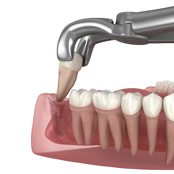 Higiene bucal en niños