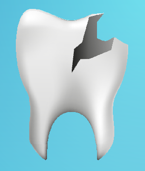 Rehabilitación oral